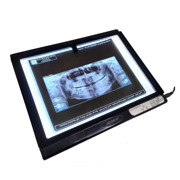 نگاتسکوپ دیجیتال عاج طب مدل MD-D